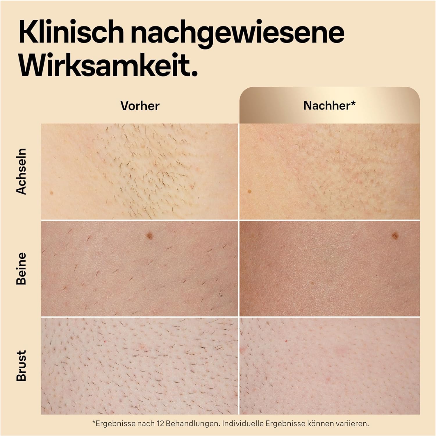 Braun Silk Expert Pro 5 PL5157